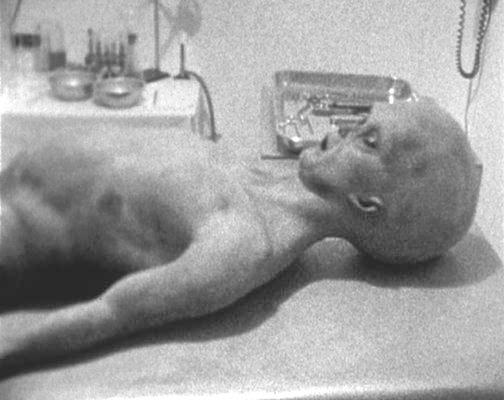 Tupac+autopsy+report